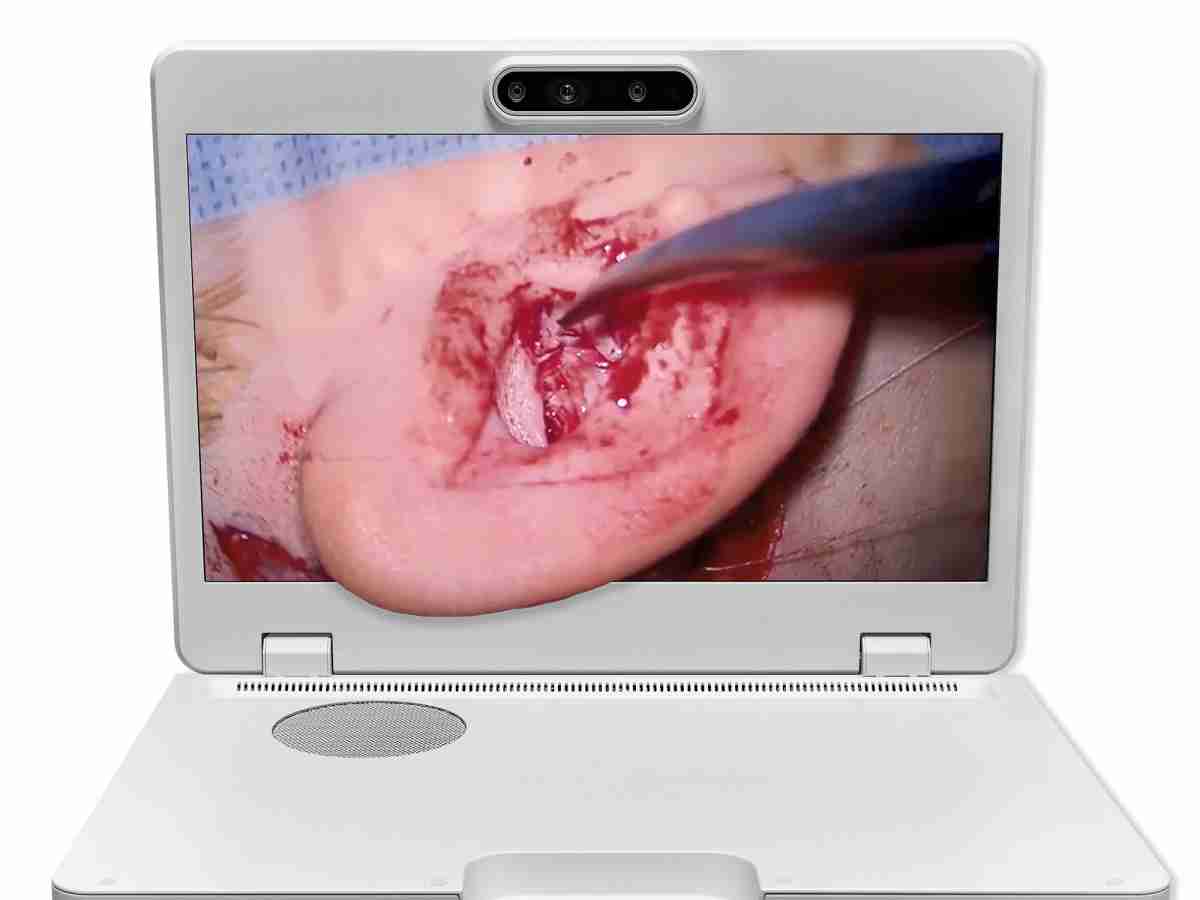 达擎之＂Heads-up 3D显微手术显示系统＂，，，整合4K裸眼3D显示及眼球追踪系统，，具备快速追踪人眼移动位置功能，，，减轻医师长时间维持固定姿势的负担，，，，让医师能有更宽广清晰的3D立体视野及更舒适的姿势来执行手术。。